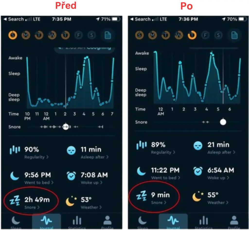 snoring before and after using Derila