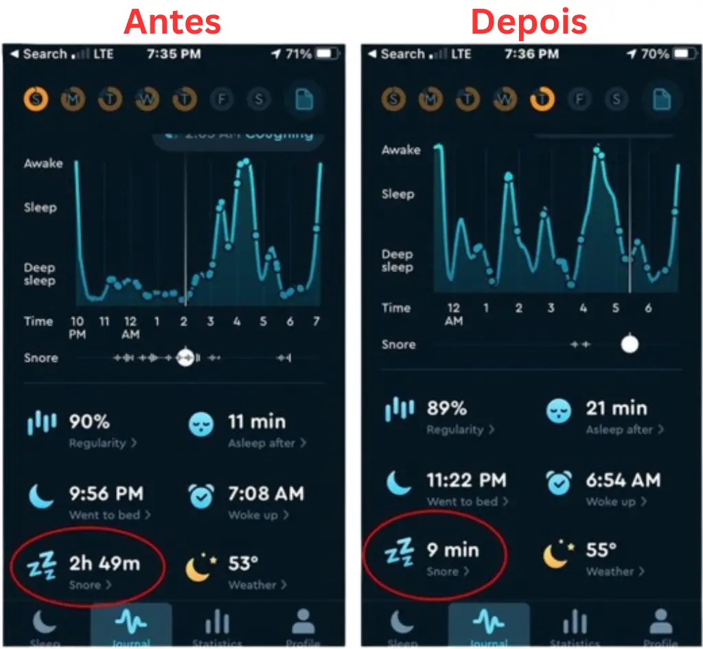 snoring before and after using Derila