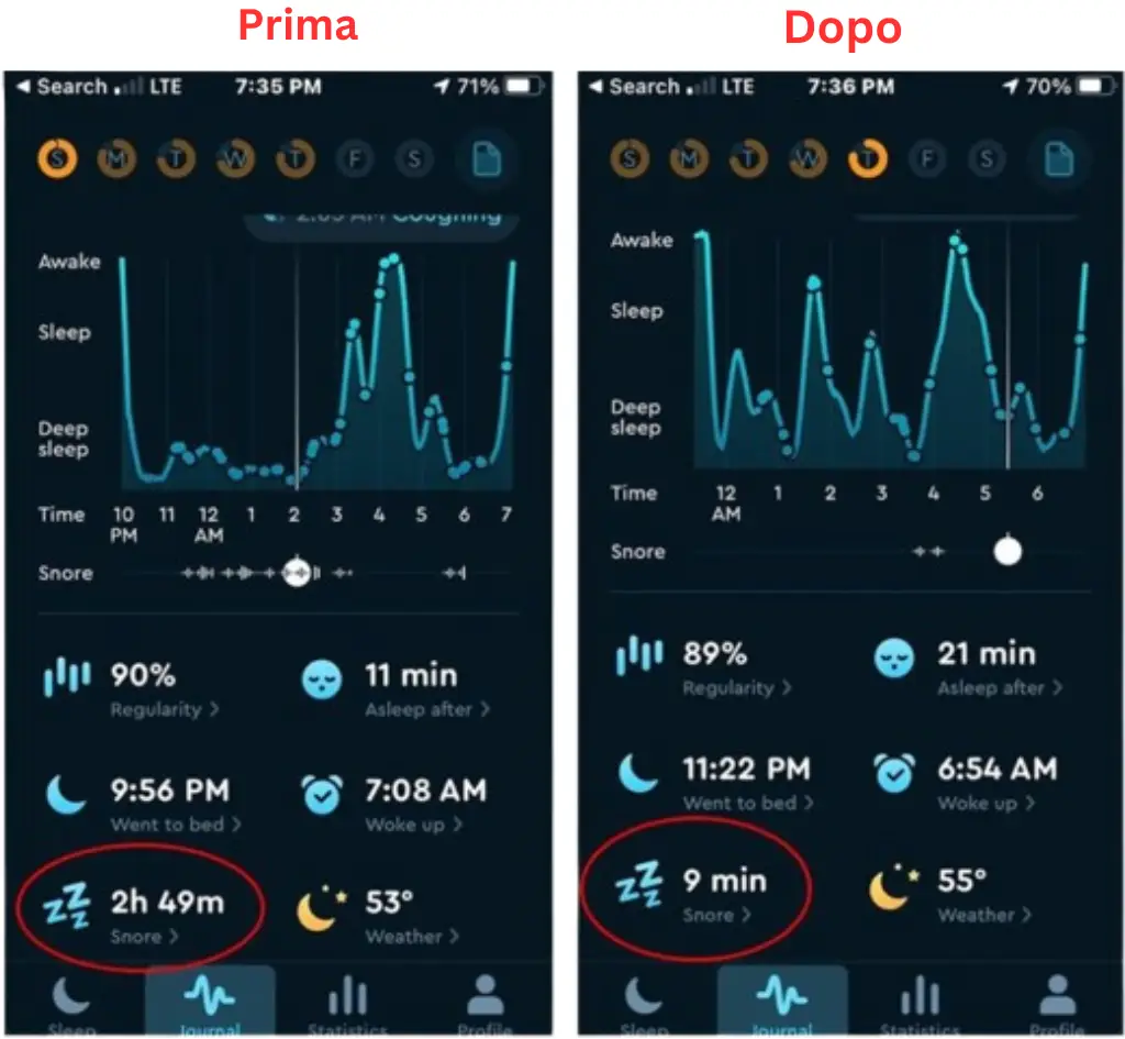 snoring before and after using Derila