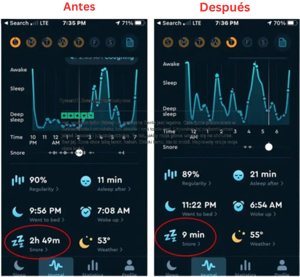 snoring before and after using Derila