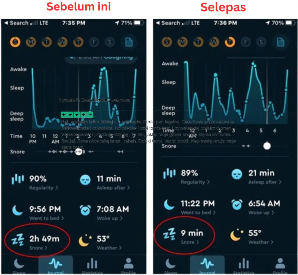 snoring before and after using Derila